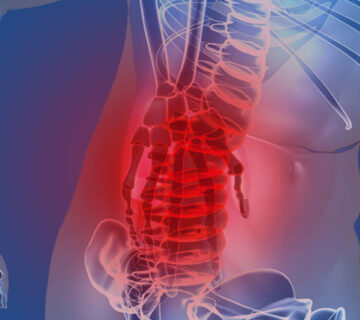 BACK INJURY FROM CAR ACCIDENT